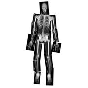 True to Life Human X-Rays
